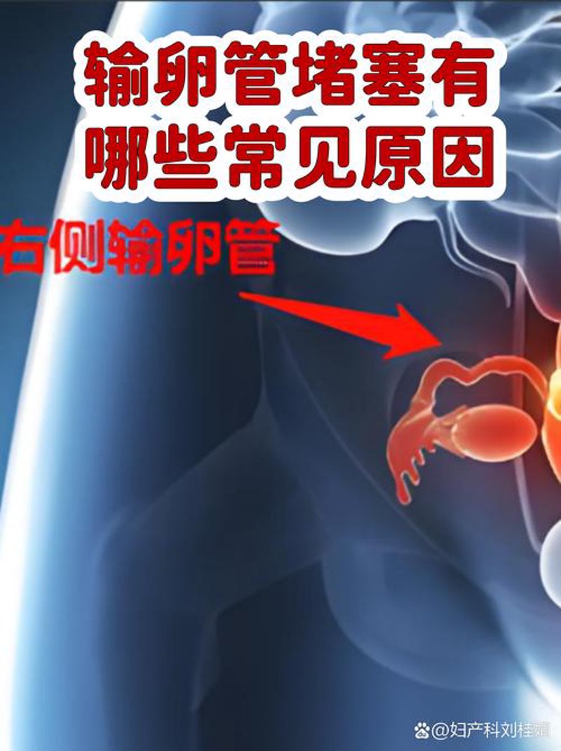 不孕不育治疗：一场与生命共舞的马拉松