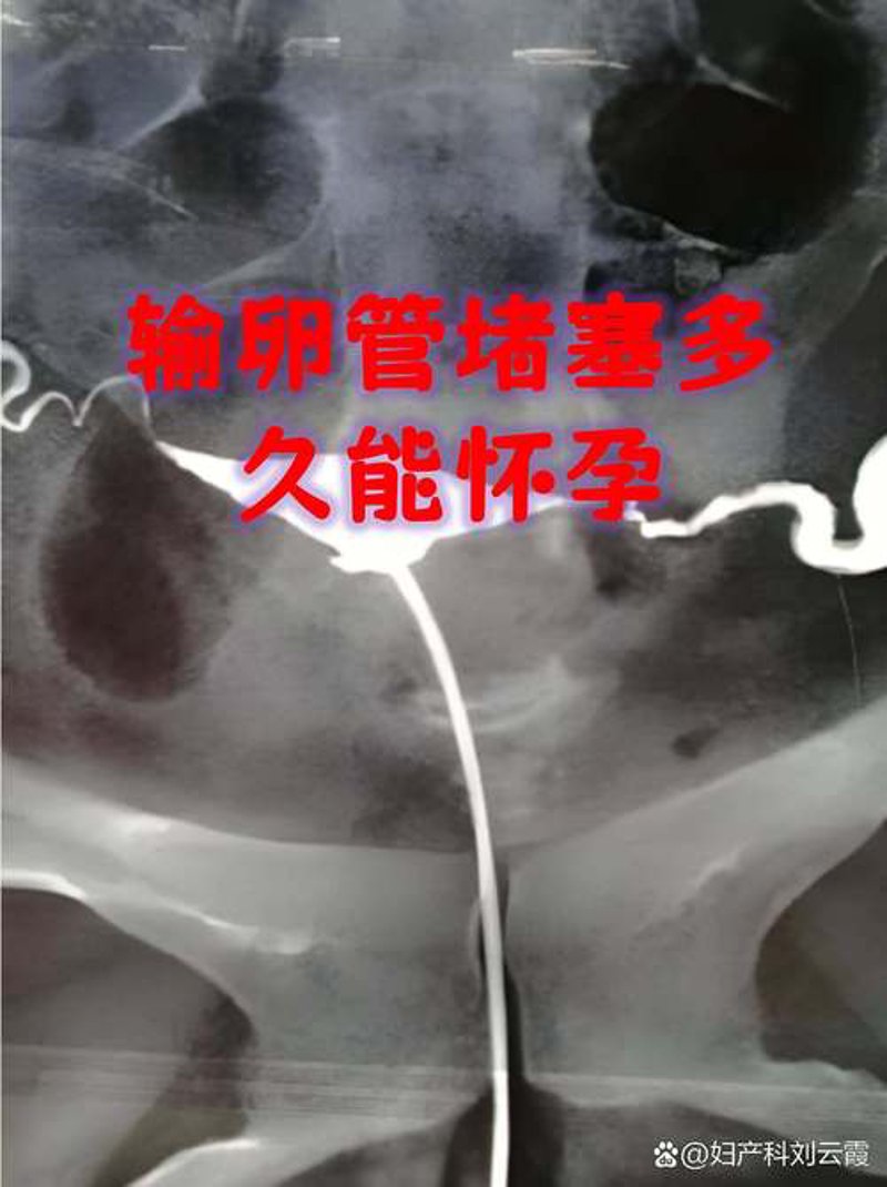呼和浩特生殖医院